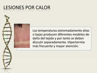 LESIONES POR CALOR
Las temperaturas extremadamente altas
o bajas producen diferentes modelos de
daño del tejido y por tanto se deben
discutir separadamente. Hipertermia
más frecuente y mayor atención.
 
