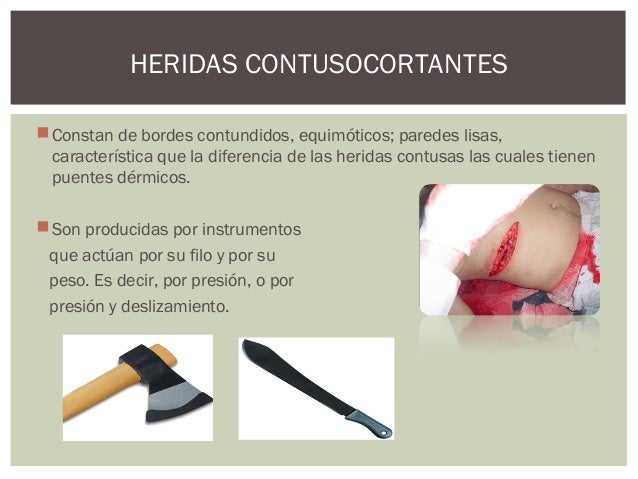 Lesiones por arma blanca