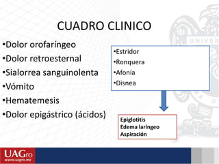 CUADRO CLINICO
•Dolor orofaríngeo
•Dolor retroesternal
•Sialorrea sanguinolenta
•Vómito
•Hematemesis
•Dolor epigástrico (ácidos)
•Estridor
•Ronquera
•Afonía
•Disnea
Epiglotitis
Edema laríngeo
Aspiración
 