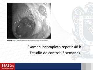 Examen incompleto repetir 48 h.
Estudio de control: 3 semanas
 