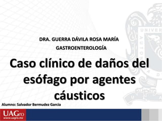 Alumno: Salvador Bermudez Garcia
DRA. GUERRA DÁVILA ROSA MARÍA
GASTROENTEROLOGÍA
Caso clínico de daños del
esófago por agentes
cáusticos
 