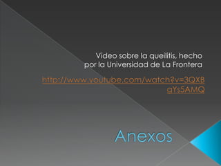 Video sobre la queilitis, hecho
por la Universidad de La Frontera
 