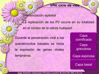 Lesiones PreCancerosas de Cervix