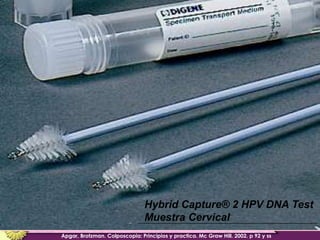 Lesiones PreCancerosas de Cervix