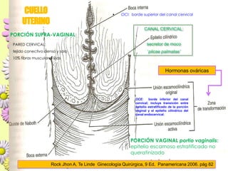 Lesiones PreCancerosas de Cervix