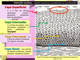 Lesiones PreCancerosas de Cervix