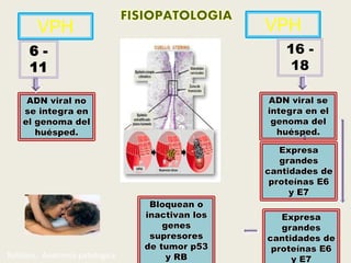 ADN viral no
se integra en
el genoma del
huésped.
VPH
6 -
11
VPH
16 -
18
ADN viral se
integra en el
genoma del
huésped.
Expresa
grandes
cantidades de
proteínas E6
y E7
Expresa
grandes
cantidades de
proteínas E6
y E7
Bloquean o
inactivan los
genes
supresores
de tumor p53
y RBRobbins. Anatomia patologica
14
 
