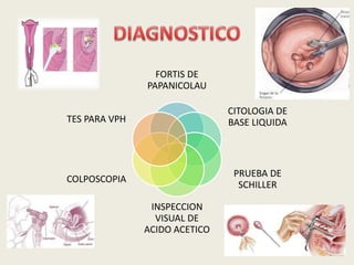 FORTIS DE
PAPANICOLAU
CITOLOGIA DE
BASE LIQUIDA
PRUEBA DE
SCHILLER
INSPECCION
VISUAL DE
ACIDO ACETICO
COLPOSCOPIA
TES PARA VPH
 
