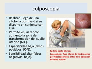 colposcopia
• Realizar luego de una
citología positiva ó si se
dispone en conjunto con
ella.
• Permite visualizar con
aumento la zona de
transformación del cuello
uterino (NIC).
• Especificidad baja (falsos
positivos: 90%).
• Sensibilidad alta (falsos
negativos: bajo).
• Epitelio aceto-blanco:
• Leucoplasia: Área blanca de límites netos,
por hiperqueratosis, antes de la aplicación
de ácido acético.
 