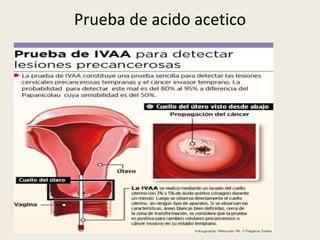 Prueba de acido acetico
 