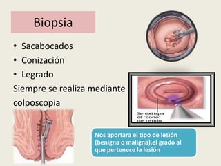 Biopsia
• Sacabocados
• Conización
• Legrado
Siempre se realiza mediante
colposcopia
Nos aportara el tipo de lesión
(benigna o maligna),el grado al
que pertenece la lesión
 