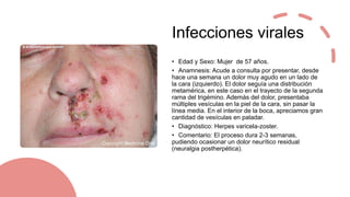 Infecciones víricas:
VVZ
• Tratamiento
• Aciclovir 800 mg 5 veces al día/7-10
días vo o Famciclovir 500mg 3 veces al
día/ ...