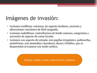 Imágenes de invasión:
• Lesiones exofíticas: extensas, de aspecto lardáceo, necrosis y
alteraciones vasculares de fácil sangrado.
• Lesiones endofíticas: crateriformes de fondo saneoso, sangrantes y
secreción de aspecto de carne lavada.
• Lesiones con aspecto de ectopía: con papilas irregulares, polimorfas,
asimétricas, con anomalías vasculares, duras y friables, que se
desprenden al examen con ácido acético.
Biopsia: simple, anular, endocervical, ampliada
 