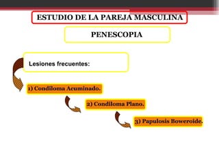 Lesiones frecuentes:
ESTUDIO DE LA PAREJA MASCULINA
2) Condiloma Plano.
1) Condiloma Acuminado.
3) Papulosis Boweroide.
PENESCOPIA
 