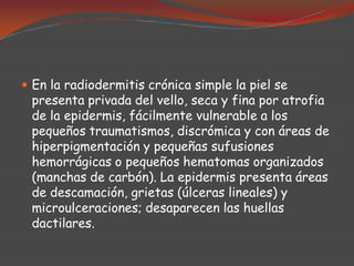 En la radiodermitis crónica simple la piel se

presenta privada del vello, seca y fina por atrofia
de la epidermis, fácilmente vulnerable a los
pequeños traumatismos, discrómica y con áreas de
hiperpigmentación y pequeñas sufusiones
hemorrágicas o pequeños hematomas organizados
(manchas de carbón). La epidermis presenta áreas
de descamación, grietas (úlceras lineales) y
microulceraciones; desaparecen las huellas
dactilares.

 