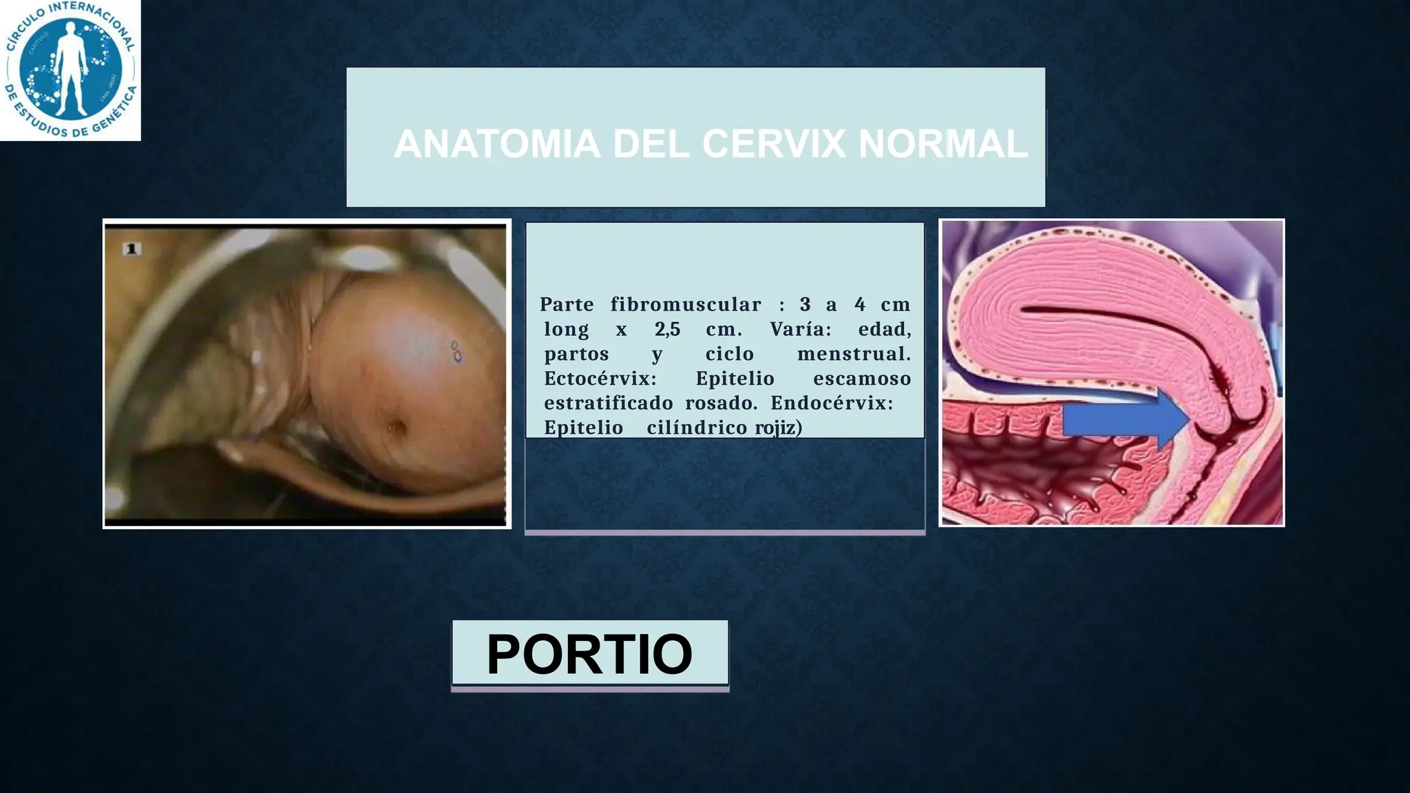 LESIONES PREMALIGNAS Y MALIGNAS DE CERVIX.v.pptx