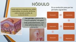 Es su evolución pasa por los
periodos siguientes:Lesión dérmica o hipodérmica, sólida
o semisólida, circunscrita, de forma,
color y tamaño variable, de
evolución lenta. Formación Crecimiento
ReblandecimientoSupuración
Ulceración
Reparación
Las gomas: nódulos de
mayor tamaño, situados
más profundamente, con
marcada tendencia a la
ulceración
 