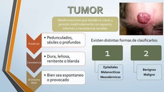 Existen distintas formas de clasificarlos:
Neoformaciones que tienden a crecer y
persistir indefinidamente con aspecto,
volumen y consistencia variable.
Puede ser
• Pedunculados,
sésiles o profundos
Consistencia
• Dura, leñosa,
renitente o blanda
El síntoma
dolor
• Bien sea espontaneo
o provocado
1
Epiteliales
Melanocíticas
Mesodérmicos
2
Benignos
Maligno
 