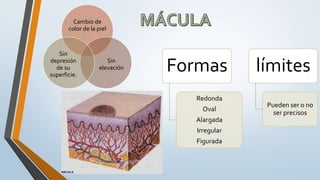 Cambio de
color de la piel
Sin
elevación
Sin
depresión
de su
superficie.
Formas
Redonda
Oval
Alargada
Irregular
Figurada
límites
Pueden ser o no
ser precisos
 