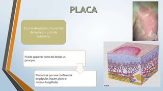 Es una elevación circunscrita
de la piel, > 1 cm de
diámetro.
Puede aparecer como tal desde un
principio.
Producirse por una confluencia
de pápulas (liquen plano o
micosis fungifoide)
 