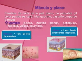 Mácula y placa:
Cambios de color de la piel, plano, no palpable (el
color puede ser café, blanquecino, castaño purpureo
o rojizo)
Ejemplo: pecas, nuevos planos, petequias,
rubeola, vitíligo, equimosis.
Mácula: < 1cm. Bordes
circunscritos.
Placa: > 1 cm. Puede
tener bordes irregulares.
 