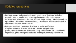 Nódulos reumáticos
• Las opacidades nodulares cavitantes en el curso de enfermedades
reumáticas son mucho más raras que las neumonías pulmonares
intersticiales y las vasculitis. Los nódulos se producen cuando las células
epiteliales cubren una zona necrótica, creando un nódulo necrobiótico,
que es el causante de la cavidad.
• Estos se localizan con mayor frecuencia en la periferia o
subpleuralmente. Pueden variar en tamaño y espesor de
pared. Normalmente son asintomáticos y se resuelven sin tratamiento
específico, pero en algunos casos se han reportado tos y hemoptisis.
 