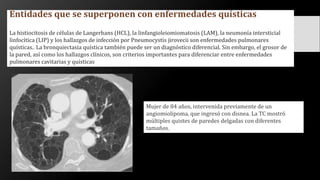 Entidades que se superponen con enfermedades quísticas
La histiocitosis de células de Langerhans (HCL), la linfangioleiomiomatosis (LAM), la neumonía intersticial
linfocítica (LIP) y los hallazgos de infección por Pneumocystis jirovecii son enfermedades pulmonares
quísticas.. La bronquiectasia quística también puede ser un diagnóstico diferencial. Sin embargo, el grosor de
la pared, así como los hallazgos clínicos, son criterios importantes para diferenciar entre enfermedades
pulmonares cavitarias y quísticas
Mujer de 84 años, intervenida previamente de un
angiomiolipoma, que ingresó con disnea. La TC mostró
múltiples quistes de paredes delgadas con diferentes
tamaños.
 