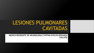LESIONES PULMONARES
CAVITADAS
MEDICO RESIDENTE DE NEUMOLOGIA CYNTHIA EVELYN ARIZANCA
CALLATA
 