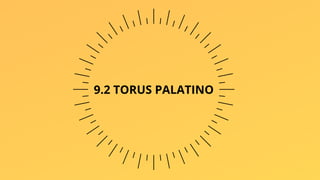9.2 TORUS PALATINO
 