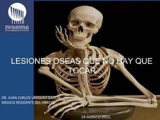 LESIONES OSEAS QUE NO HAY QUE
TOCAR
DR. JUAN CARLOS VAZQUEZ GARCIA
MEDICO RESIDENTE DEL HRAEPY
24-AGOSTO-2015.
 