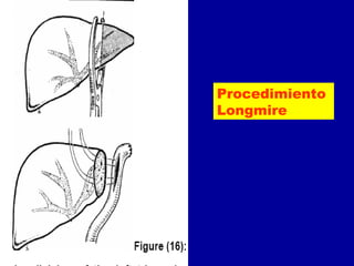         

         




                        Procedimiento
                        Longmire
                     

                     
 