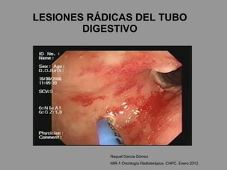 LESIONES RÁDICAS DEL TUBO DIGESTIVO Raquel García Gómez MIR-1 Oncología Radioterápica. CHPC. Enero 2012. 