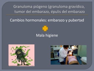 Cambios hormonales: embarazo y pubertad
Mala higiene
 
