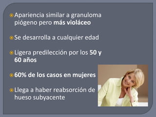 Apariencia similar a granuloma
piógeno pero más violáceo
Se desarrolla a cualquier edad
Ligera predilección por los 50 y
60 años
60% de los casos en mujeres
Llega a haber reabsorción de
hueso subyacente
 