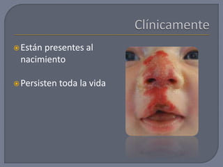 Están presentes al
nacimiento
Persisten toda la vida
 