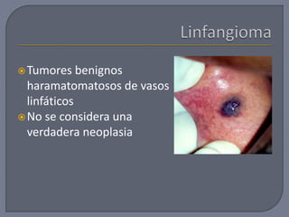 Tumores benignos
haramatomatosos de vasos
linfáticos
No se considera una
verdadera neoplasia
 
