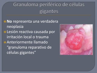 No representa una verdadera
neoplasia
Lesión reactiva causada por
irritación local o trauma
Anteriormente llamado
“granuloma reparativo de
células gigantes”
 