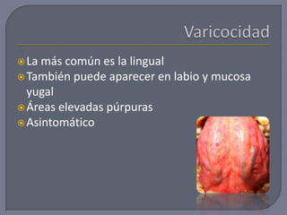 La más común es la lingual
También puede aparecer en labio y mucosa
yugal
Áreas elevadas púrpuras
Asintomático
 