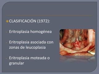 CLASIFICACIÓN (1972):
- Eritroplasia homogénea
- Eritroplasia asociada con
zonas de leucoplasia
- Eritroplasia moteada o
granular
 