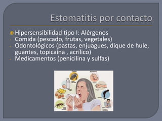  Hipersensibilidad tipo I: Alérgenos
- Comida (pescado, frutas, vegetales)
- Odontológicos (pastas, enjuagues, dique de hule,
guantes, topicaína , acrílico)
- Medicamentos (penicilina y sulfas)
 