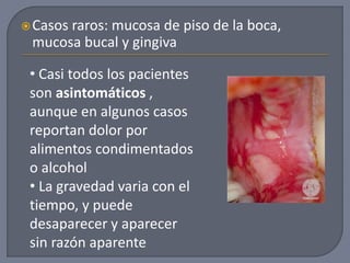 Casos raros: mucosa de piso de la boca,
mucosa bucal y gingiva
• Casi todos los pacientes
son asintomáticos ,
aunque en algunos casos
reportan dolor por
alimentos condimentados
o alcohol
• La gravedad varia con el
tiempo, y puede
desaparecer y aparecer
sin razón aparente
 