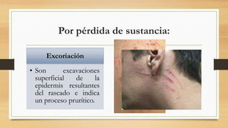 Lesiones secundarias de la piel-dermatología | PPTX