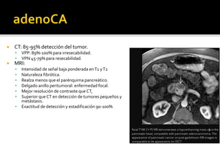  CT: 85-95% detección del tumor.
 VPP: 89%-100% para irresecabilidad.
 VPN 45-79% para resecabilidad.
 MRI:
 Intensidad de señal baja ponderada enT1 yT2
 Naturaleza fibrótica.
 Realza menos que el parénquima pancreático.
 Delgado anillo peritumoral: enfermedad focal.
 Mejor resolución de contraste que CT,
 Superior que CT en detección de tumores pequeños y
metástasis.
 Exactitud de detección y estadificación 90-100%
 