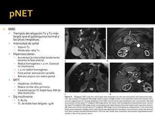  MRI:
 Tiempos de relajaciónT1 yT2 más
largos que el parénquima normal y
las otras neoplasias.
 Intensidad de señal
▪ baja enT1.
▪ Moderada –altaT2.
 Hipervasculares:
▪ Aumentan la intensidad ávidamente
durante la fase arterial.
▪ Realce homogéneo < 2 cm. Esencial
en insulinoma
▪ < 2 cm realce homogéneo.
▪ Fase portal: atenuación variable.
▪ Retraso atípico con realce portal.
 MTT:
▪ Hepáticas –linfáticas.
▪ Realce similar al tu primario.
▪ Caracterización TC doble fase, RM de
alta resolución.
 Dg insulinoma
▪ S: 85-64
▪ Tc: de doble fase delgado: 94%
 