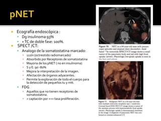  Ecografía endoscópica :
 Dg insulinoma 93%
 +TC de doble fase: 100%.
 SPECT /CT:
 Analogo de la somatostatina marcado:
▪ 111In (octreotido radiomarcado)
▪ Absorbido por Receptores de somatostatina
▪ Mayoria de los pNET ( no en insulinoma)
▪ S y E: 90 -80%
▪ Mejora la interpretación de la imagen.
▪ Afectación de órganos adyacentes.
▪ Permite la exploración de todo el cuerpo para
la detección de pequeños tu y mtt.
 FDG
▪ Aquellos que no tienen receptores de
somatostatina.
▪ > captación por +++ tasa proliferación.
 