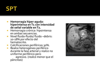  Hemorragia hiper-aguda:
hiperintensa enT1 con intensidad
de señal variable enT2.
 Hemorragia crónica: hipointensa
en ambas secuencias.
 Nivel fluido-fluido/ fluido –debris:
10-18% por efecto del
hematocrito.
 Calcificaciones periféricas 30%.
 Realce heterogéneo periférico
durante la fase arterial y realce no
uniforme periférico pero
agresivo. (realce menor que el
páncreas)
 