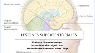LESIONES SUPRATENTORIALES
Modulo de Neuroanestesiología
Impartido por el Dr. Miguel Lopez
Residente de tercer año Sonia Juárez Zúñiga
 