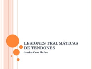 LESIONES TRAUMÁTICAS DE TENDONES  Jessica Cruz Muños  