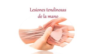 Lesiones tendinosas
de la mano
 