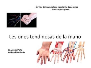 Lesiones tendinosas de la mano
Servicio de traumatología hospital JM Casal ramos
Araure – portuguesa
Dr. Jesus Peña
Medico Residente
 